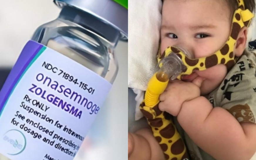 SUS Disponibiliza Zolgensma, um dos Remédios Mais Caros do Mundo, Gratuitamente