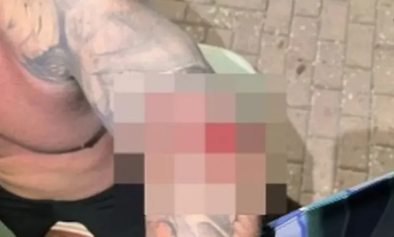 Pescador é atacado por tubarão ao tentar remover anzol e leva 91 pontos no braço