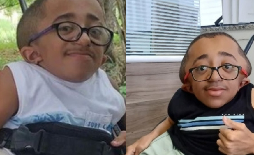 Morr*, aos 15 anos, o adolescente que sofria com ‘ossos de vidro’ em Feira de Santana