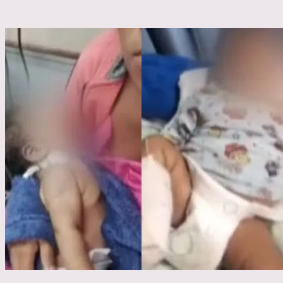 Bebê de 2 meses tem pés amputados após complicações; MP investiga possível erro médico