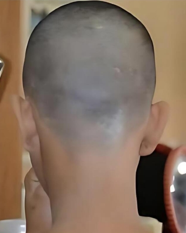 Jovem tem cabelo raspado após se envolver com homem casado e provocar esposa nas redes