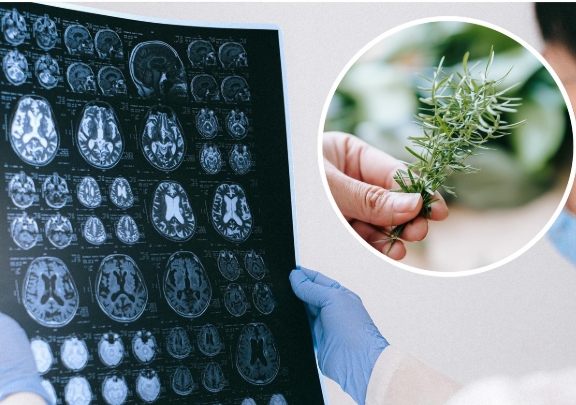 Novo estudo revela que composto encontra no alecrim pode ajudar no combate ao Alzheimer