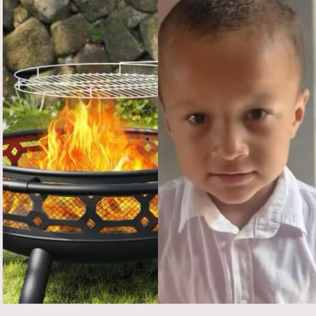 Menino de 5 anos fica gravemente ferido após explosão de churrasqueira em Palmas