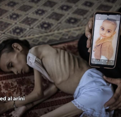 MEU DES! Menina palestino de 9 anos morrendo* de fome após Israel bloquear a ajuda humanitária em Gaza
