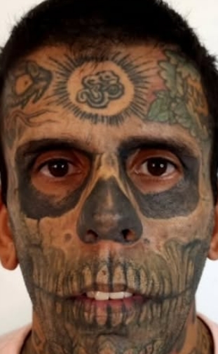 “Homem mais tatuado do Brasil” compartilha progresso na remoção de tatuagens no rosto