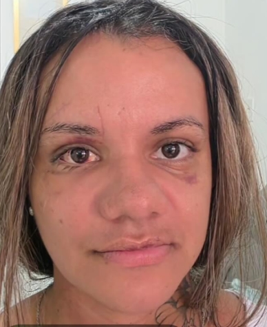 Um mês após agressão brutal, Juliana Garcia celebra avanços na reconstrução facial: “Minha identidade de volta”