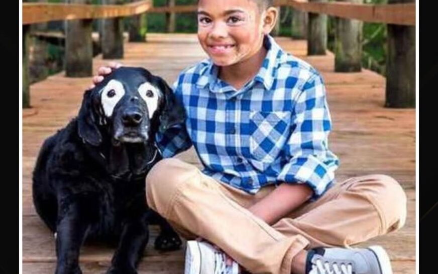 Menino supera depressão após conhecer cão com a mesma condição de pele