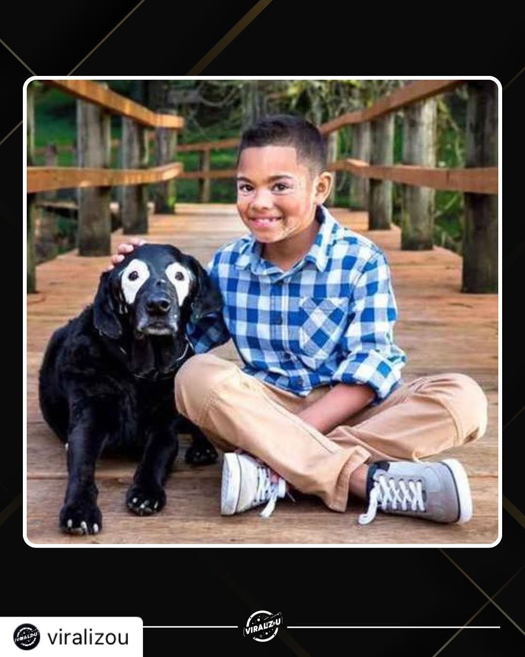 Menino supera depressão após conhecer cão com a mesma condição de pele